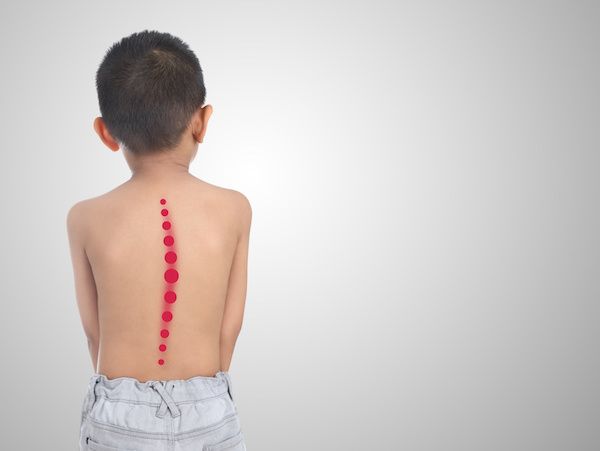 Especialista en Deformidades Óseas Infantiles | Dr. Daniel Machuca
