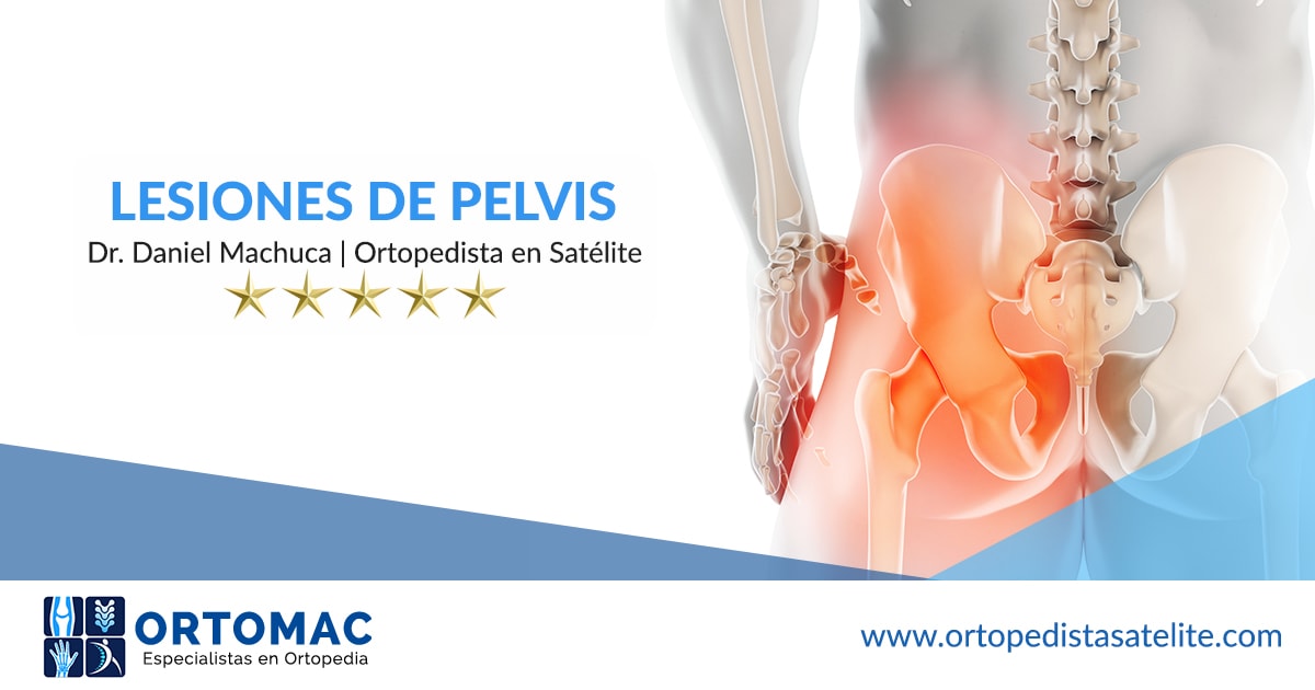 Especialista en Lesiones de Pelvis y Acetábulo Dr. Daniel Machuca
