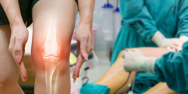 Cuánto Cuesta Una Cirugía De Rodilla En México Dr Daniel Machuca